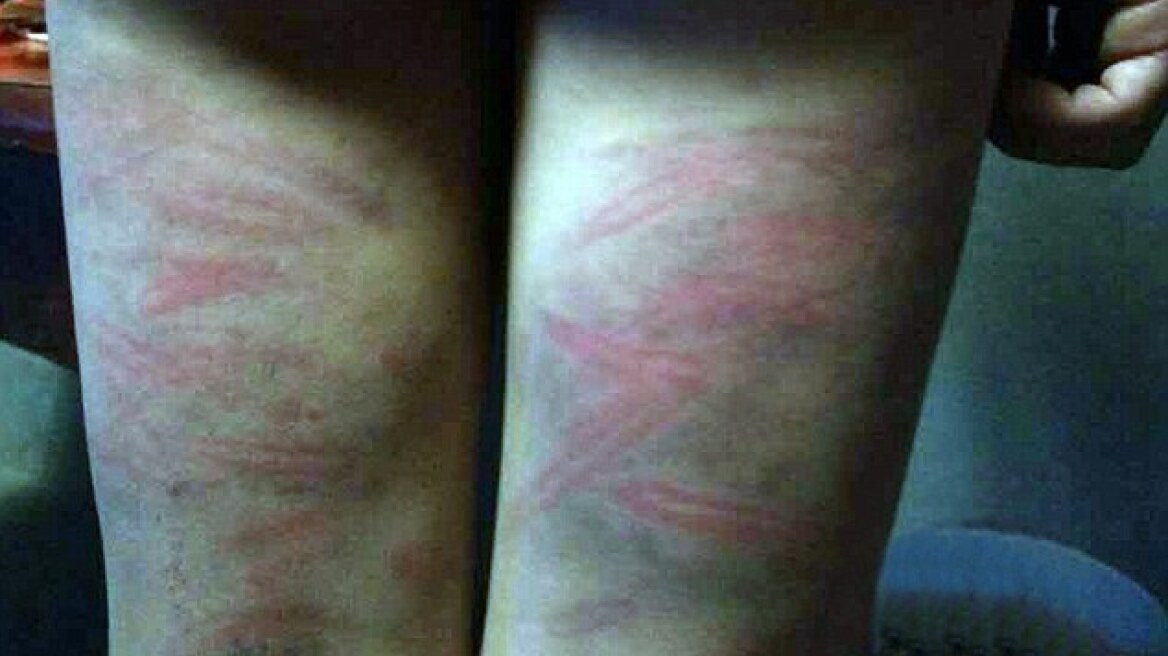 Αδιανόητο: Δάσκαλος μαστίγωσε μαθητή επειδή έκανε λάθος σε άσκηση στα μαθηματικά