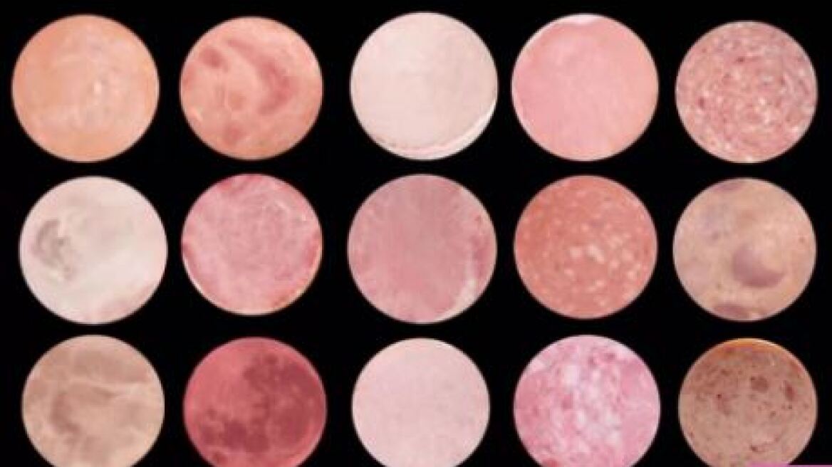 Ποιο είναι το φεγγάρι και ποια τα ζαμπόν