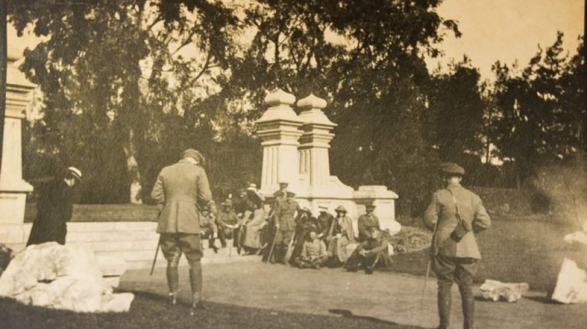 Φωτογραφίες που σοκάρουν: Οι πρώτες πλαστικές επεμβάσεις σε θύματα πολέμου