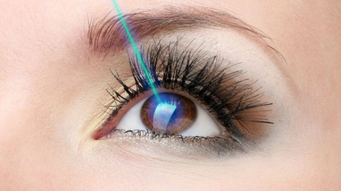 Διαθλαστική Χειρουργική: Όσα πρέπει να γνωρίζετε για το Laser για μυωπία