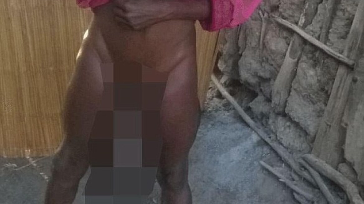 Δεν μπορεί να κάνει σεξ, λόγω... μεγέθους