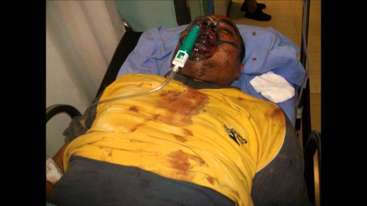 Δίκη Χρυσής Αυγής: 15 μαυροφορεμένοι με χτυπούσαν, μου έσπασαν τα δόντια και το κεφάλι