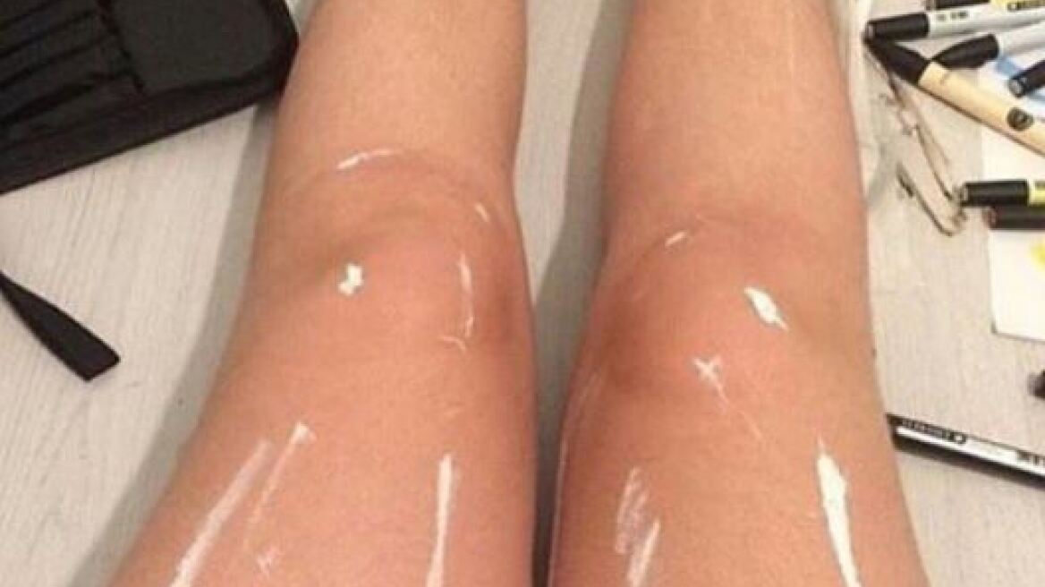 Η φωτογραφία που έγινε viral: Πόδια που... γυαλίζουν ή κάτι άλλο; 