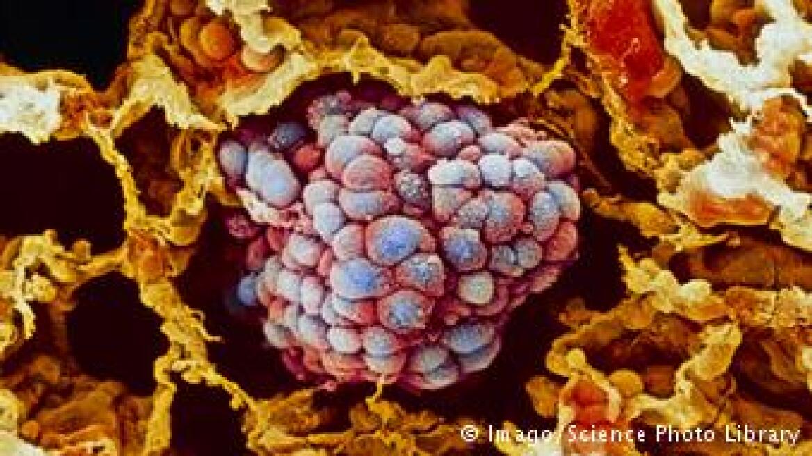 Smoking results in permanent scars on cells