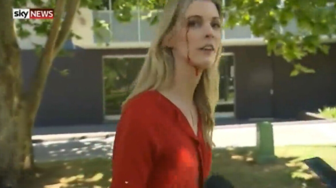 Βίντεο: Στα αίματα δημοσιογράφος μετά από επίθεση συζύγου κατηγορούμενου για οπλοκατοχή