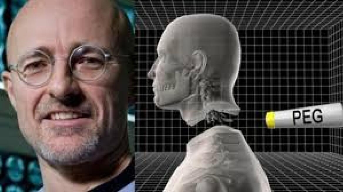 World’s first head transplant to be performed