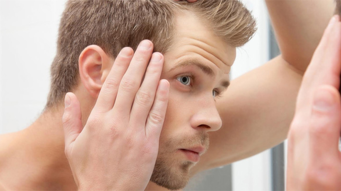 Αραίωση Μαλλιών: Και τώρα τι κάνω;