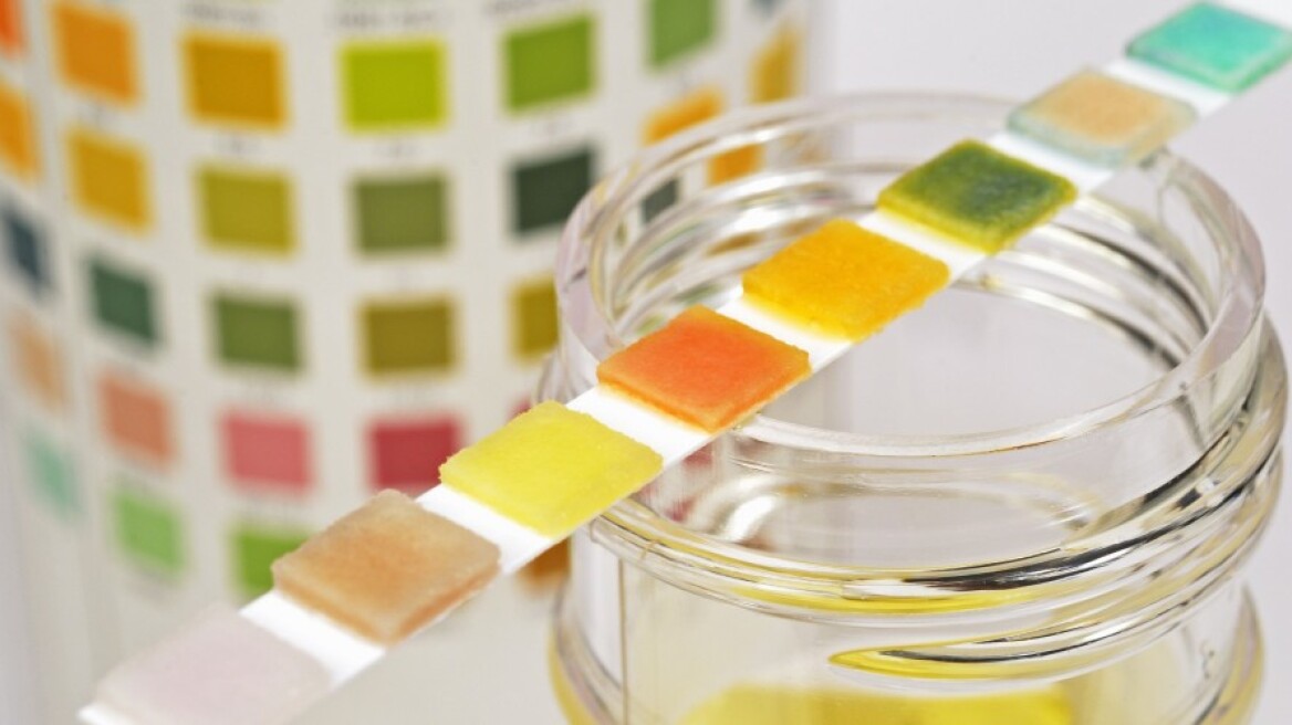 Ενα τεστ ούρων μπορεί  να ανιχνεύσει πόσο υγιεινή διατροφή κάνει κάποιος