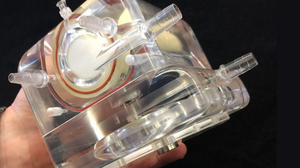 Φορητός τεχνητός «πνεύμονας» που μεταφέρεται σε σακίδιο πλάτης