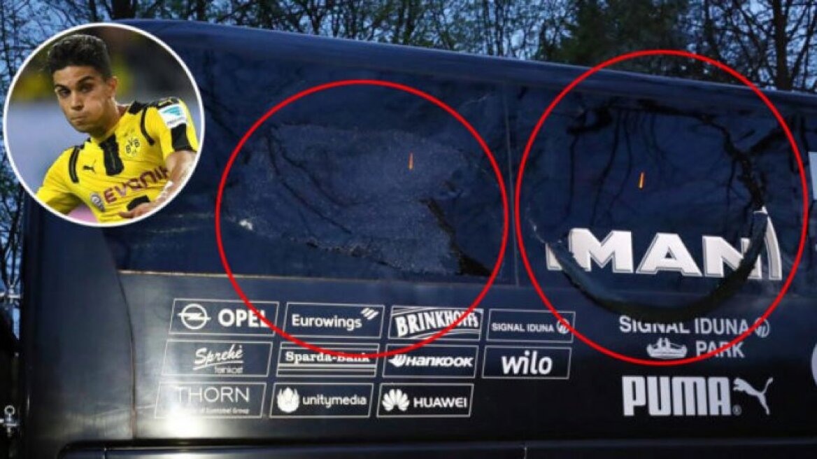 Επίθεση στο Ντόρτμουντ: Υποβάλλεται σε επέμβαση ο Μπάρτρα