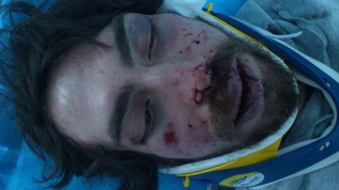 Βίντεο: Μου έριχναν μπουνιές και κλωτσιές στο κεφάλι, λέει ο φοιτητής που ξυλοκοπήθηκε από χρυσαυγίτες