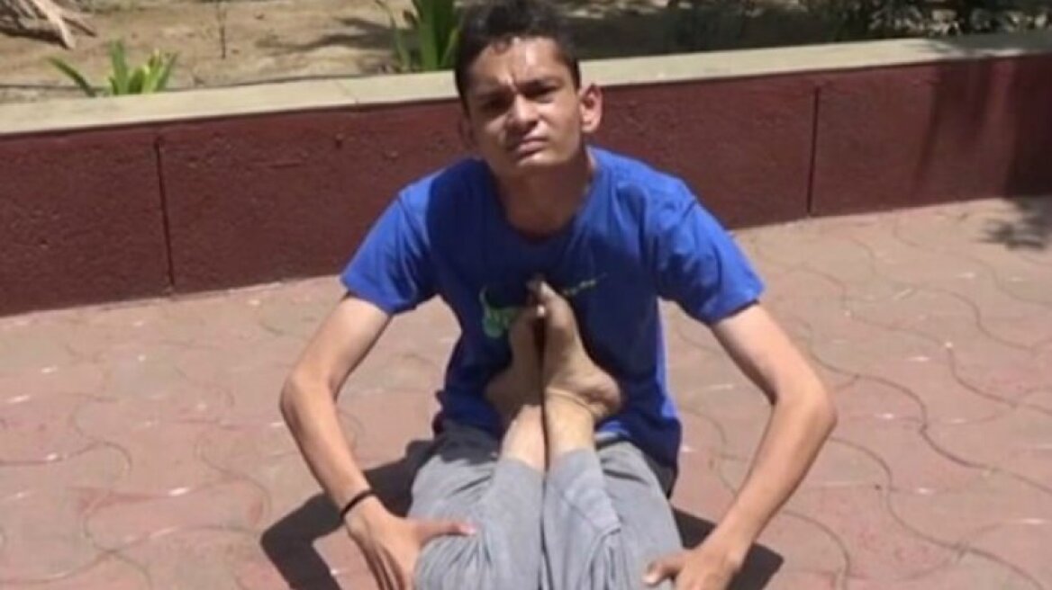 Ο 18χρονος που... δεν έχει κόκαλα (vid & pics)