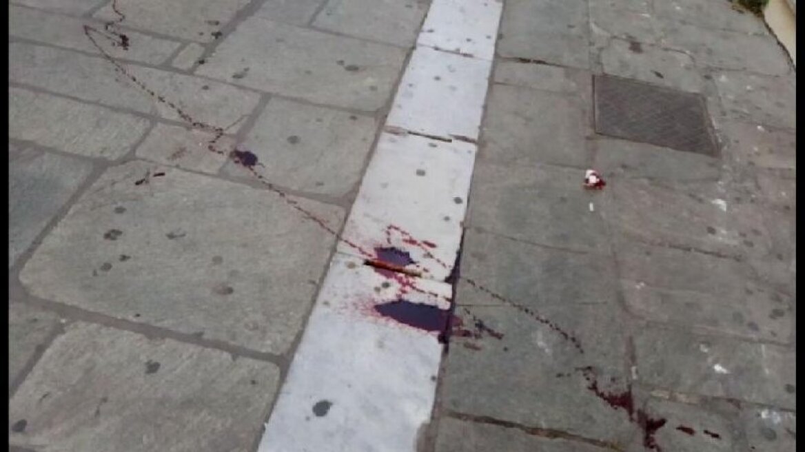 Αιματηρή συμπλοκή οπαδών τα ξημερώματα στο κέντρο του Βόλου