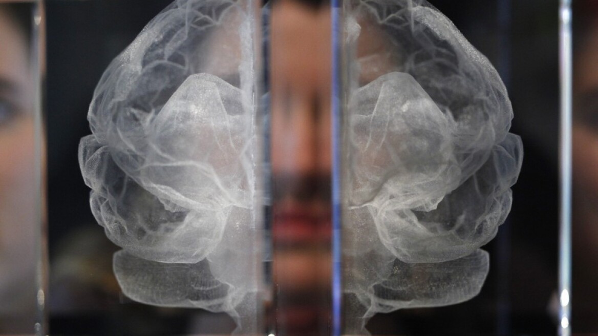 How poverty changes the brain