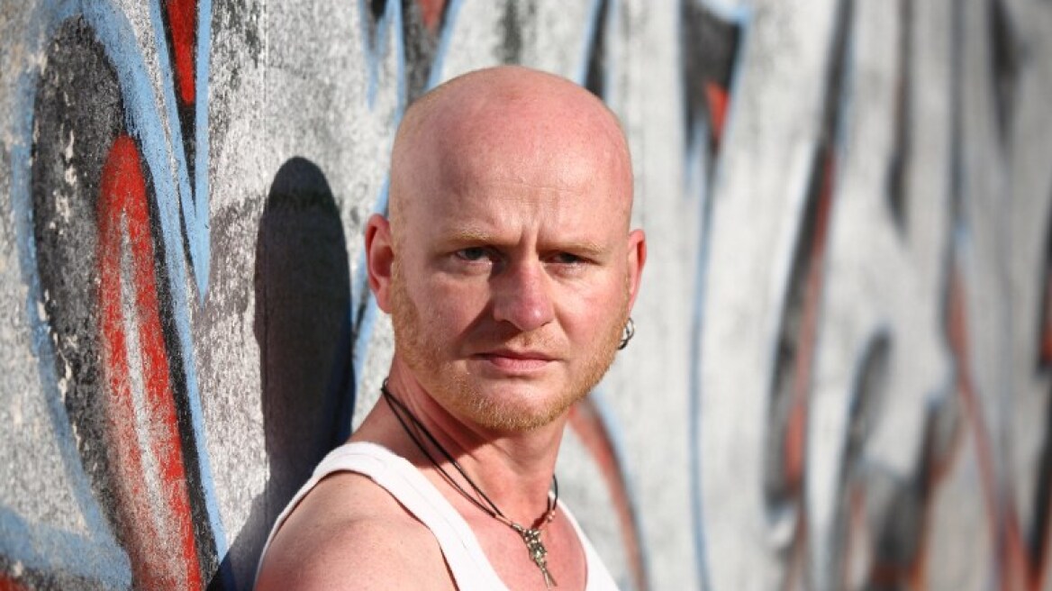 Τυχαία ανακάλυψη ανοίγει τον δρόμο για τη θεραπεία της... φαλάκρας