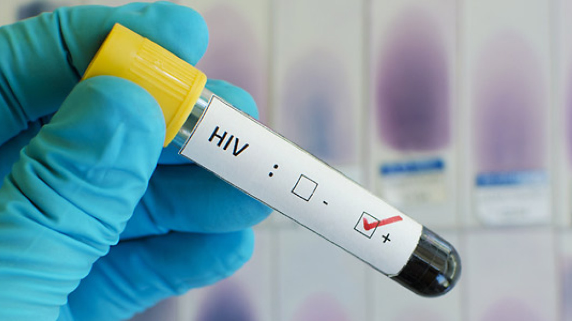 AIDS: Επιστήμονες δημιούργησαν καλύτερο και φθηνότερο τεστ ανίχνευσης του ιού