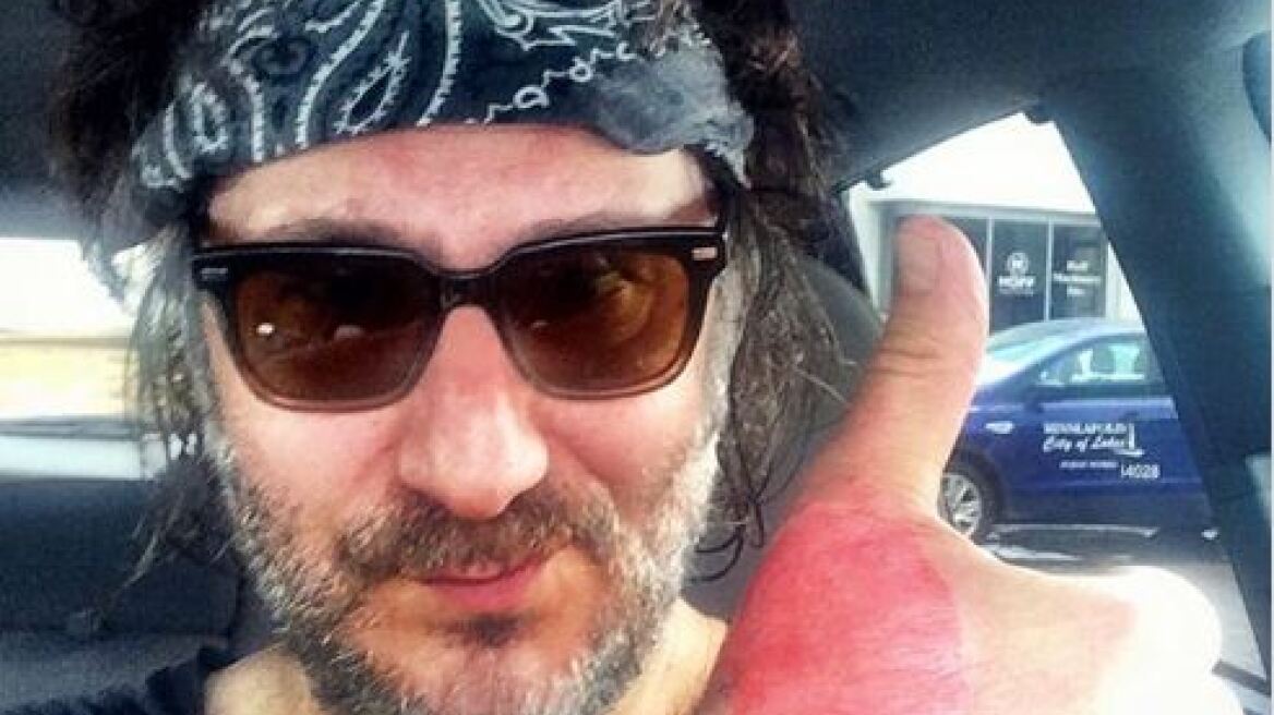 ΗΠΑ: 52χρονος υπέστη έγκαυμα δευτέρου βαθμού από... χυμό λάιμ!