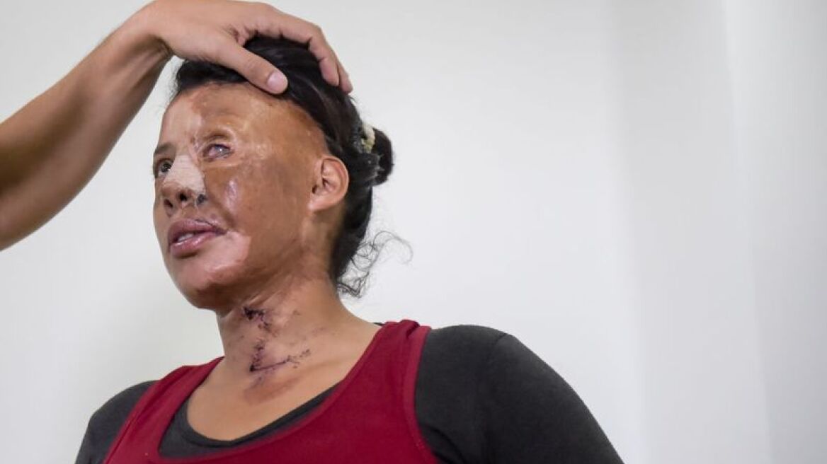 Acid attacks increase in London (infographic)