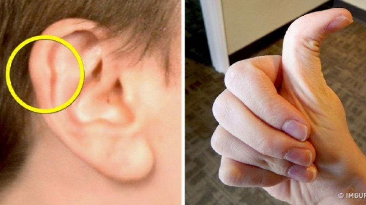 Έντεκα απροσδόκητα σημάδια ότι έχετε ένα μοναδικό σώμα