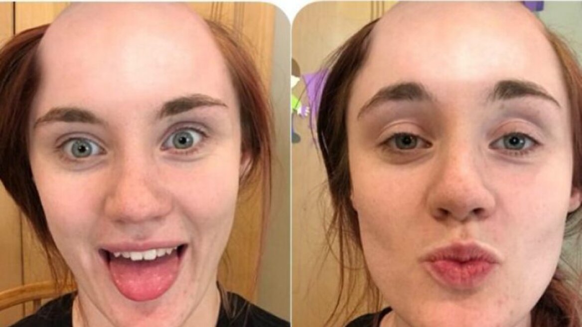 Αυτή η γυναίκα έστειλε φωτογραφία με καράφλα στο αγόρι της κι εκείνος τρελάθηκε (pics)