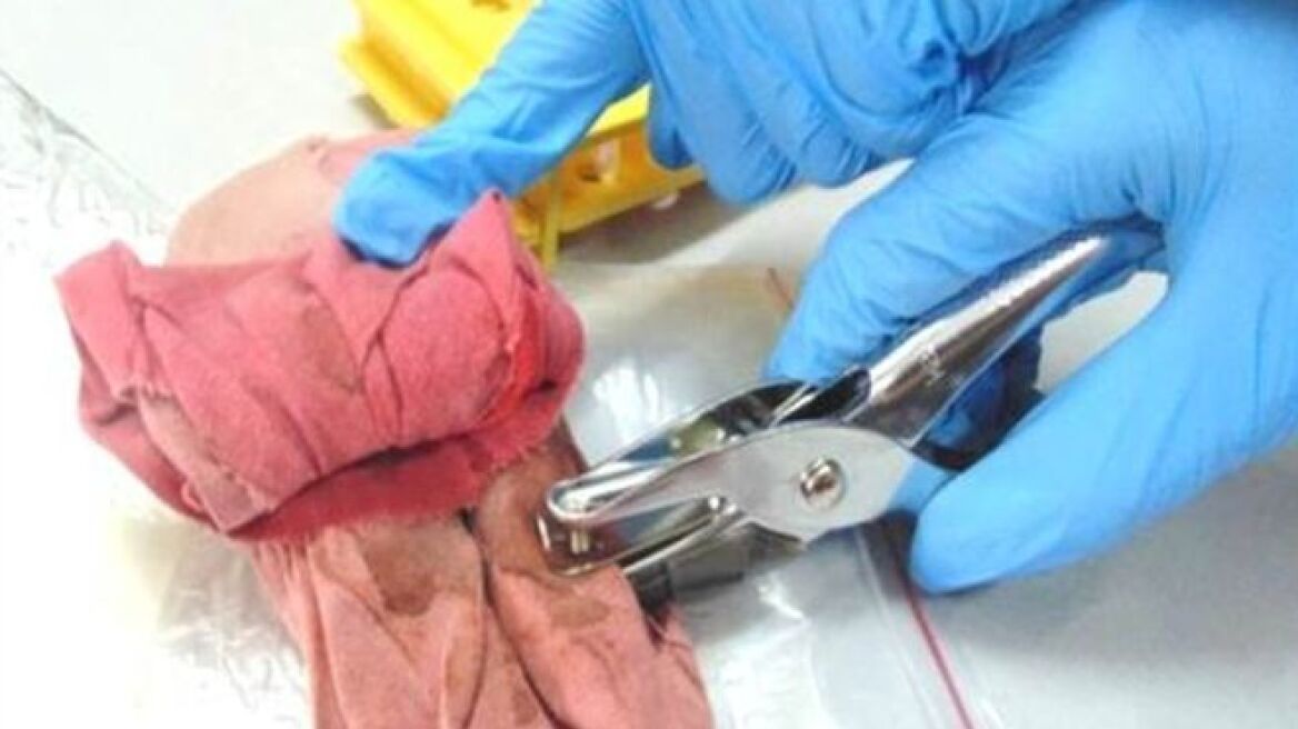 Γιατί στην Ινδία μαζεύουν τις χρησιμοποιημένες σερβιέτες;