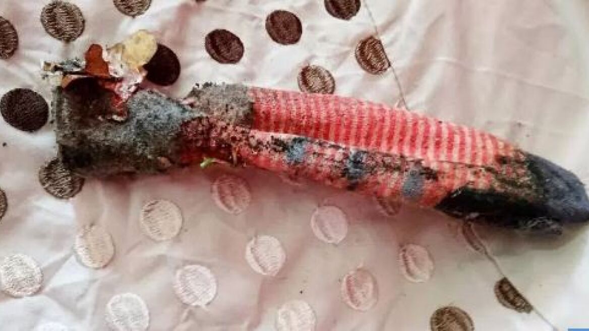 Βρετανία: Φώναξαν τη φιλοζωική για φοβερή σαύρα που αποδείχθηκε... άπλυτη κάλτσα!