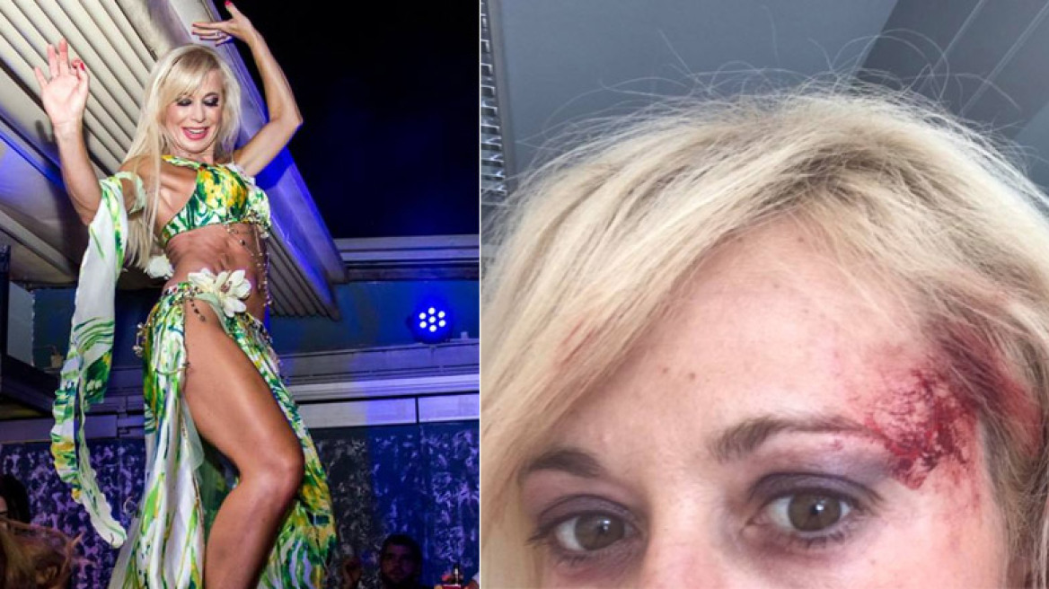 Θύμα ξυλοδαρμού η γνωστή χορεύτρια οριεντάλ Αλεξάνδρα Φωτεινού