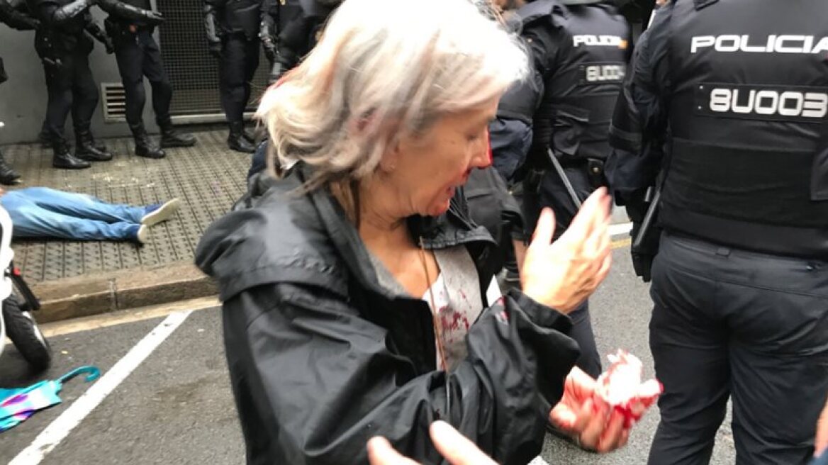 Ο ΟΗΕ καλεί τις ισπανικές αρχές να διεξάγουν έρευνα για τη βία στην Καταλονία