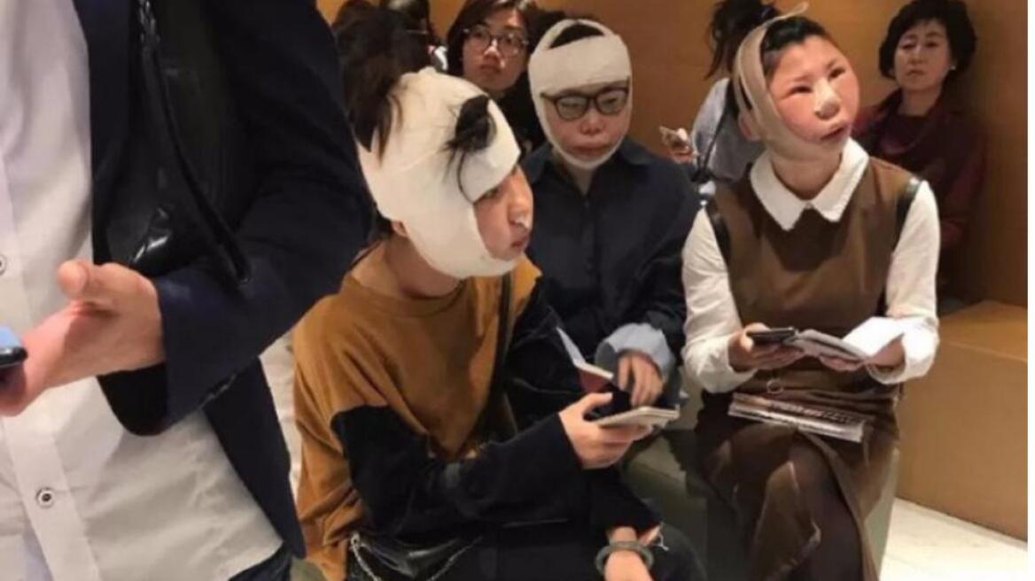 Απίστευτη εικόνα: Πήγαν για λίφτινγκ στη Σεούλ και γύρισαν παραμορφωμένες!