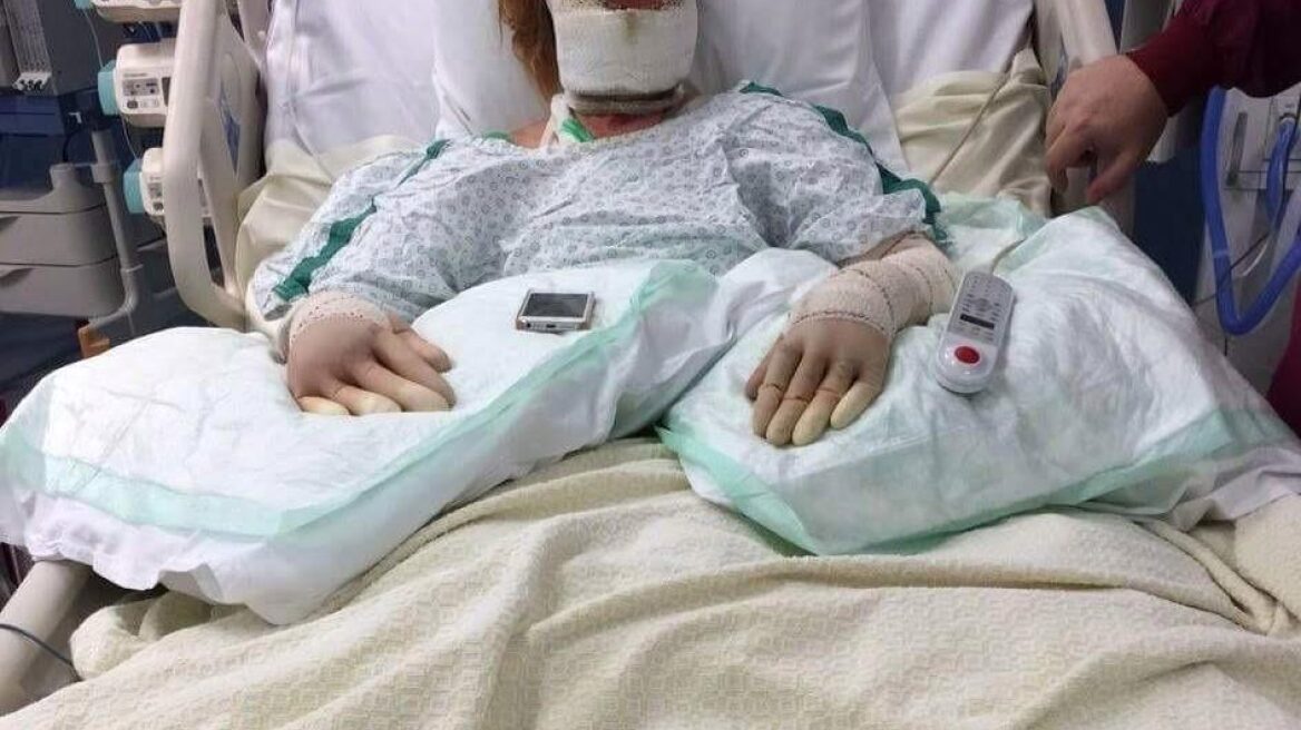 Βέλγιο: 25χρονη άνοιξε το καπάκι της κατσαρόλας και... κόντεψε να καεί ζωντανή!