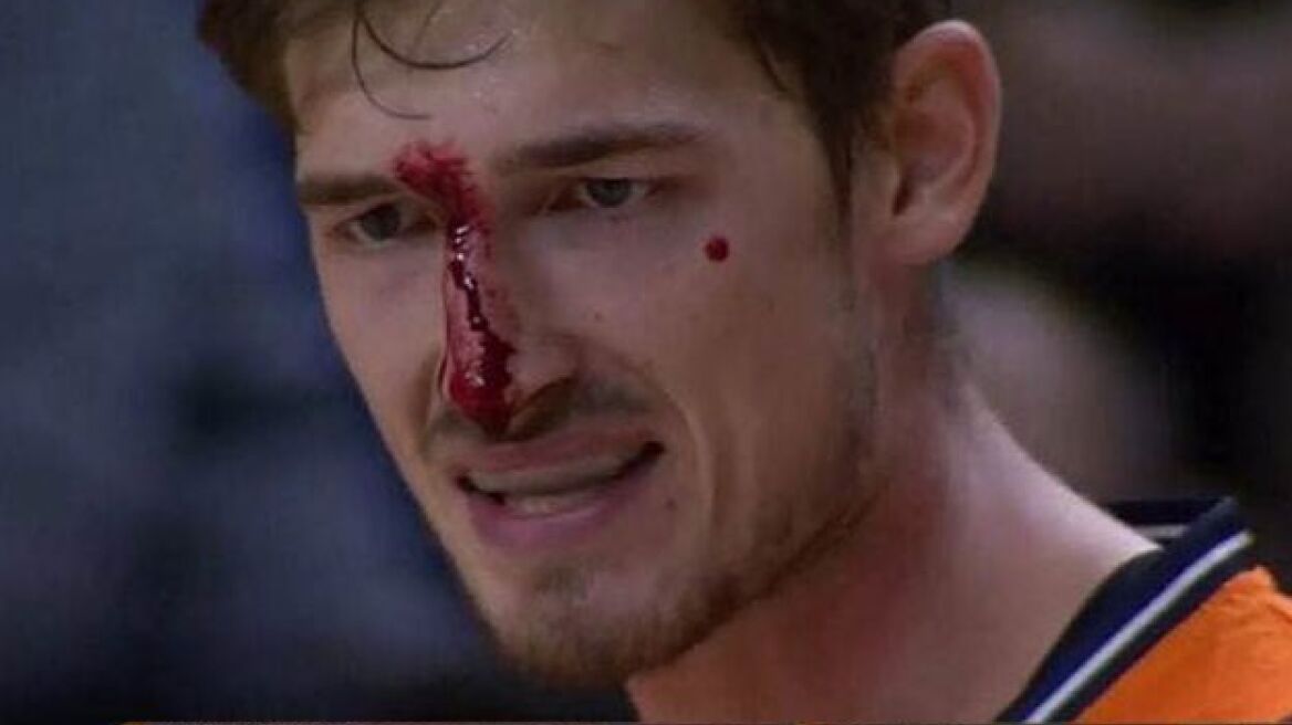 Ξέφυγε εντελώς ο Ντόντσιτς και αποβλήθηκε! (VIDEO)