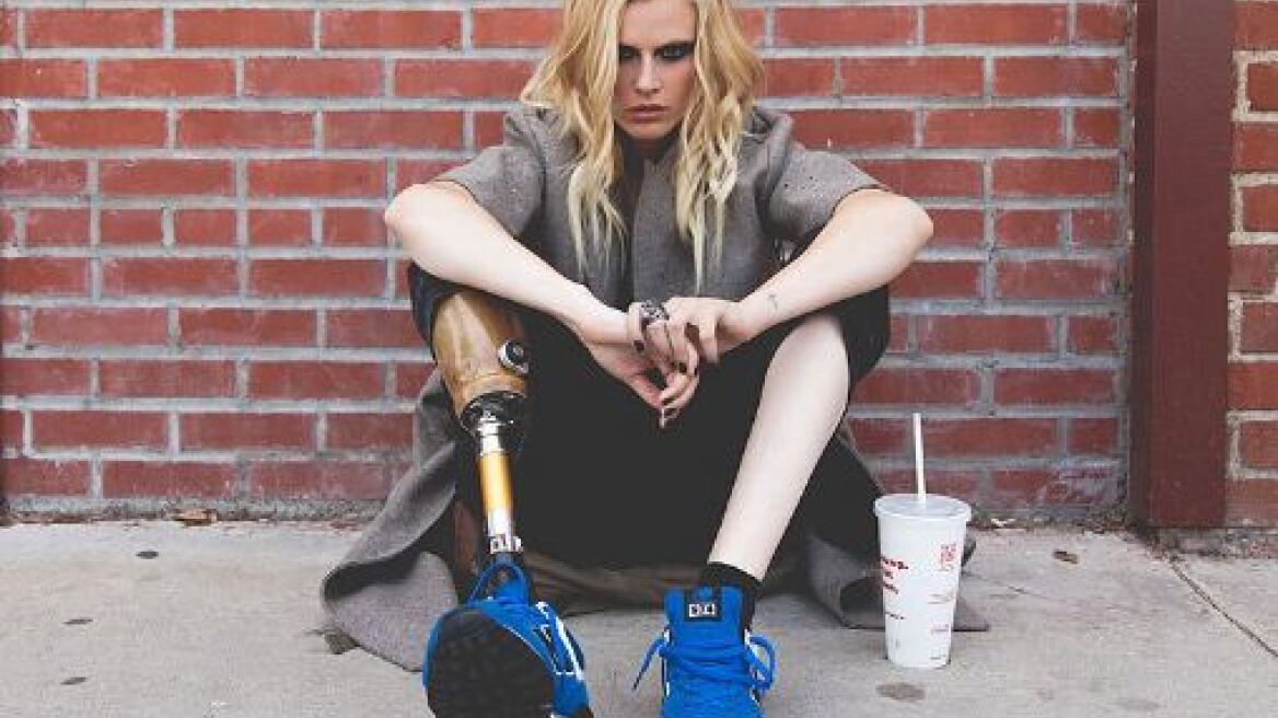 Τραγικό: Το μοντέλο που έχασε το δεξί του πόδι από χρήση ταμπόν θα χάσει σύντομα και το αριστερό