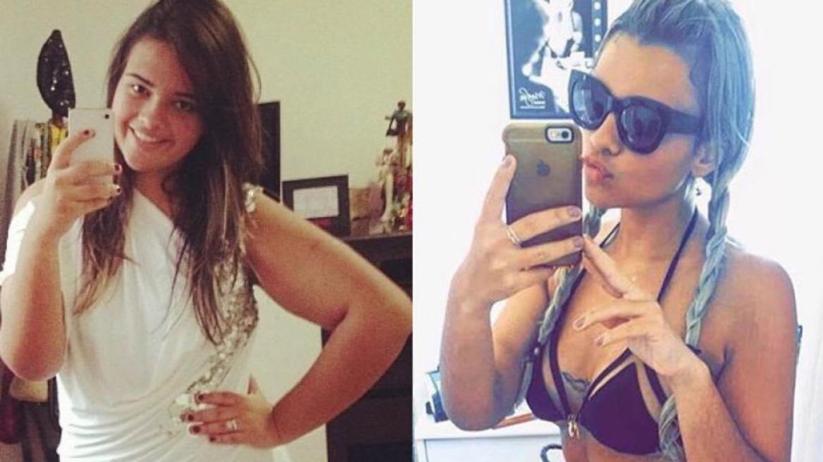 Μία 24χρονη έχασε 80 κιλά και έγινε... μοντέλο (pics)