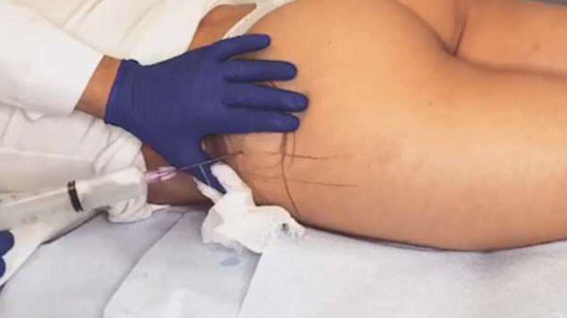 Γεμίζει τα οπίσθιά της και το δείχνει στην κάμερα