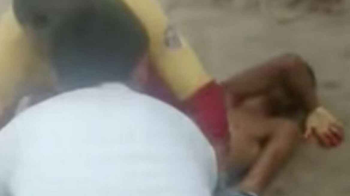 Καρχαρίας έκοψε με τα δόντια του το πέος λουόμενου