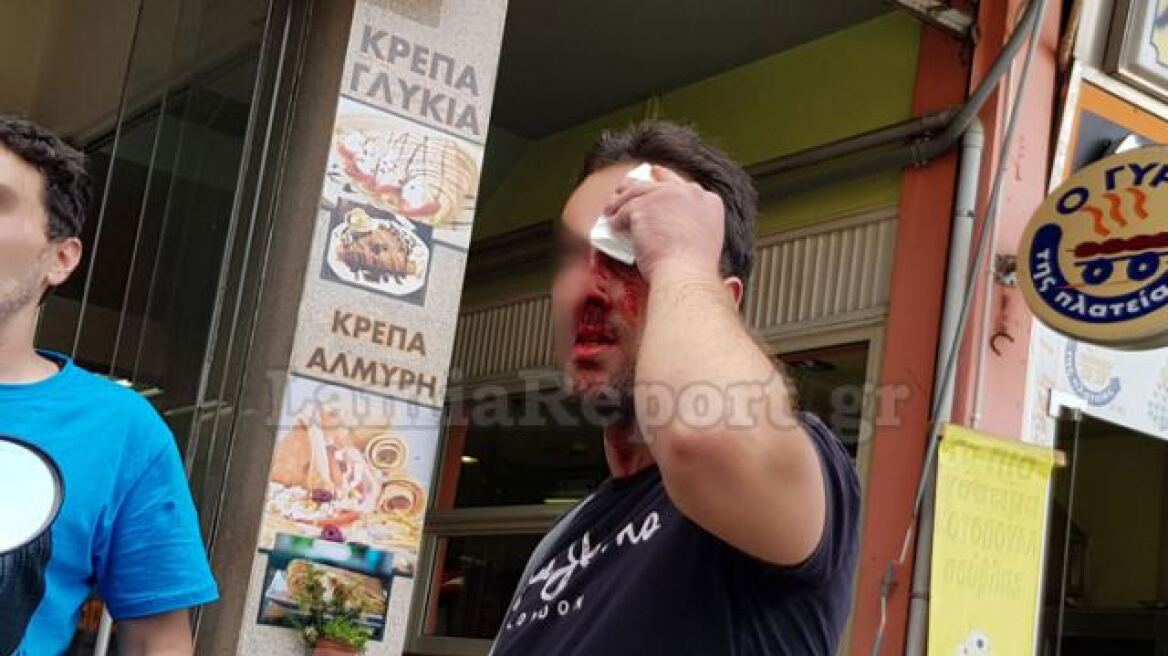 Λαμία: Ρομά «άνοιξαν» κεφάλια με καδρόνια στην πλατεία Πάρκου