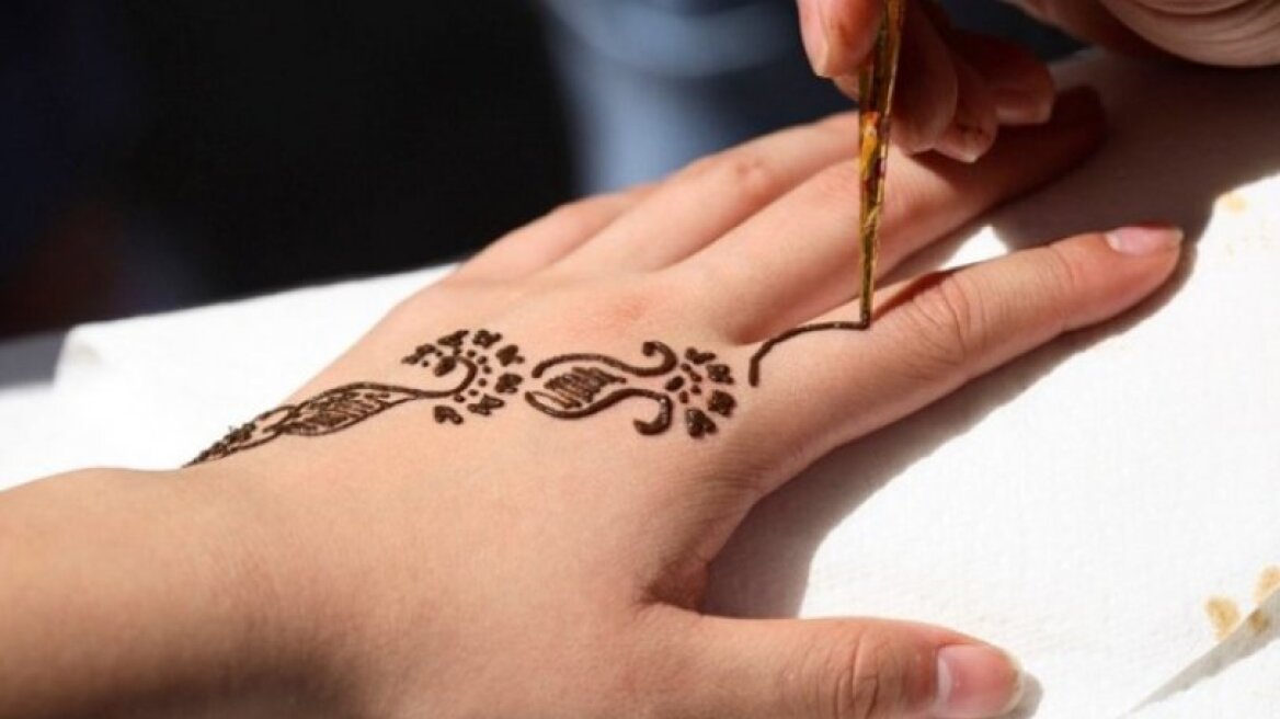 Έπαθαν εγκαύματα από τατουάζ «χένα» και παραλίγο να χάσουν τα άκρα τους (pics)