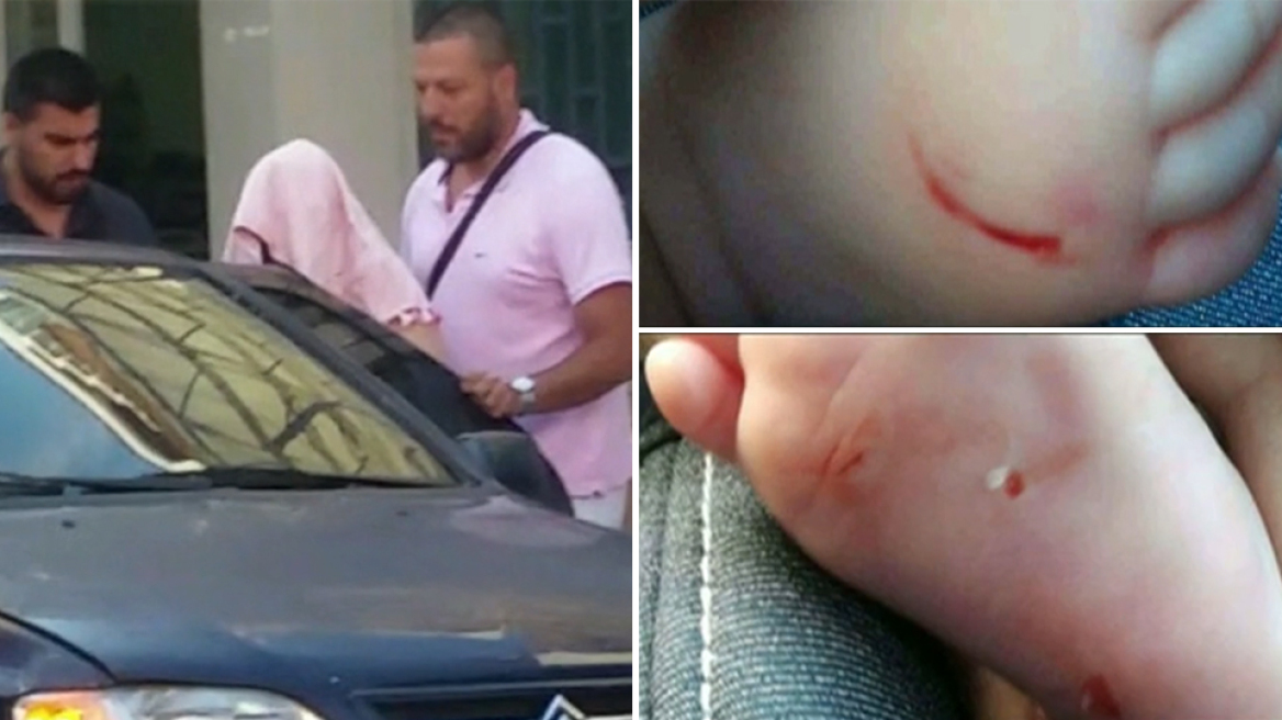 Υπό αστυνομική φύλαξη νοσηλεύεται στο Δρομοκαΐτειο η 55χρονη που χαράκωνε μωρά