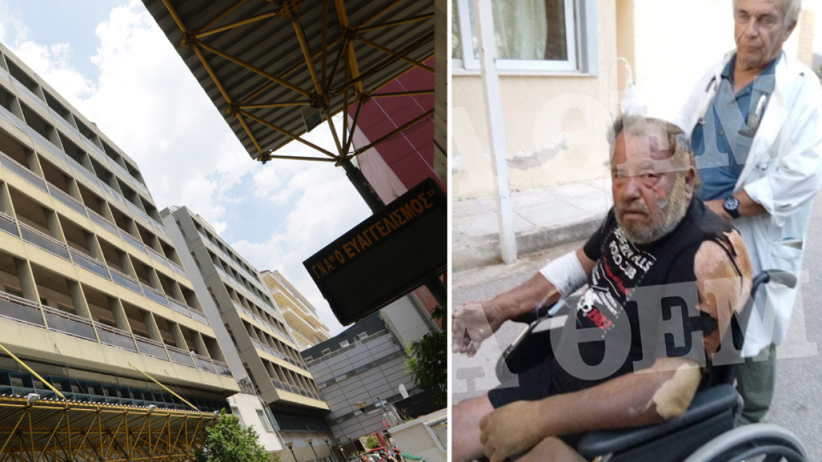 Φωτιά στο Μάτι: Μάχη για τη ζωή τους δίνουν 11 τραυματίες στις Εντατικές