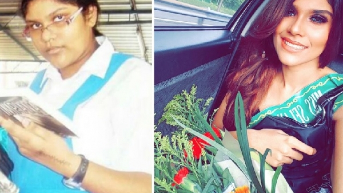 Στο σχολείο την κορόιδευαν και την φώναζαν χοντρή - Σήμερα είναι διάσημο μοντέλο!