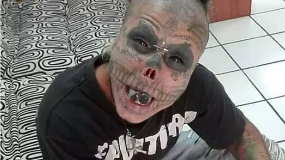 Τρομακτική μεταμόρφωση: Έκοψε τη μύτη, τα αυτιά του και τη γλώσσα του για να μοιάζει με ζωντανό σκελετό