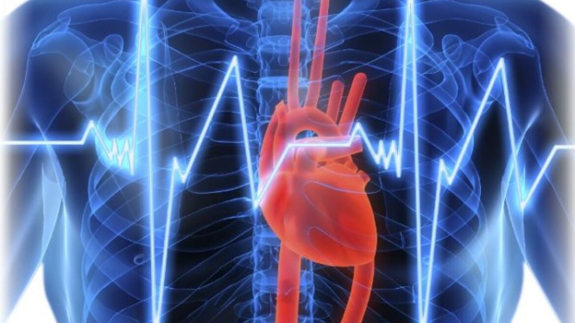 Πώς η κολπική μαρμαρυγή σχετίζεται με την εμφάνιση αγγειακού εγκεφαλικού επεισοδίου 