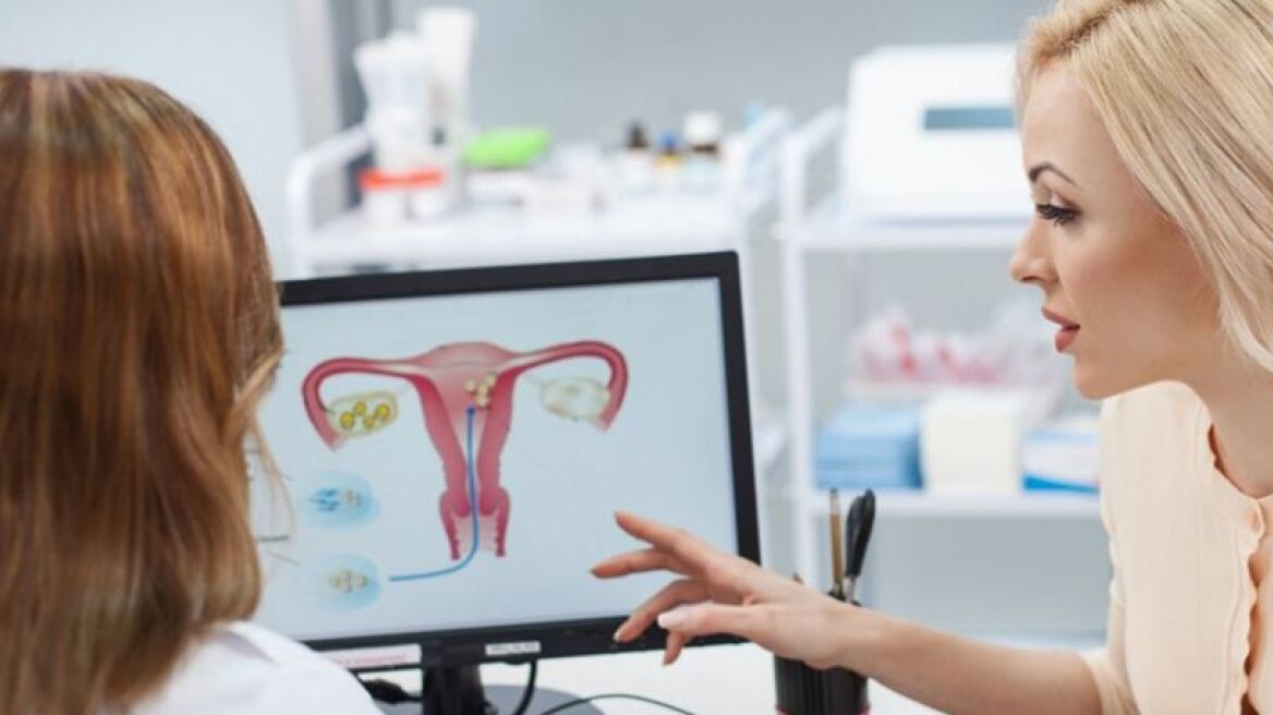 Αν εμφανίζεις αυτά τα συμπτώματα, έχεις κύστες στις ωοθήκες