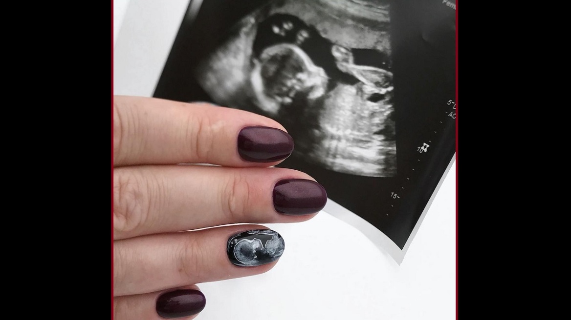 Το μανικιούρ σε άλλη διάσταση: Νύχια για μέλλουσες μαμάδες