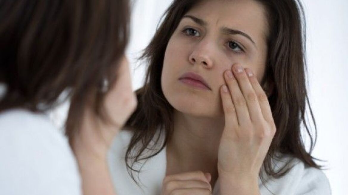 3 φυσικές τροφές για τους μαύρους κύκλους