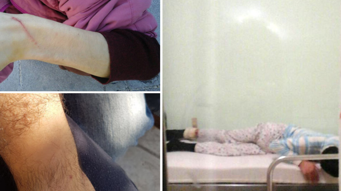 Τραγική εξέλιξη: Απεβίωσε ένα από τα άτομα με αυτισμό που έδεναν στο Λοιμωδών