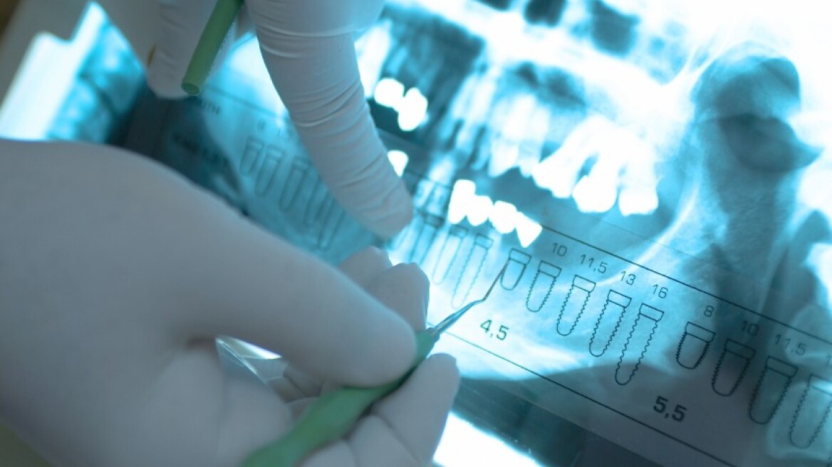 Νανο-εμφυτεύματα αποκαθιστούν την κίνηση