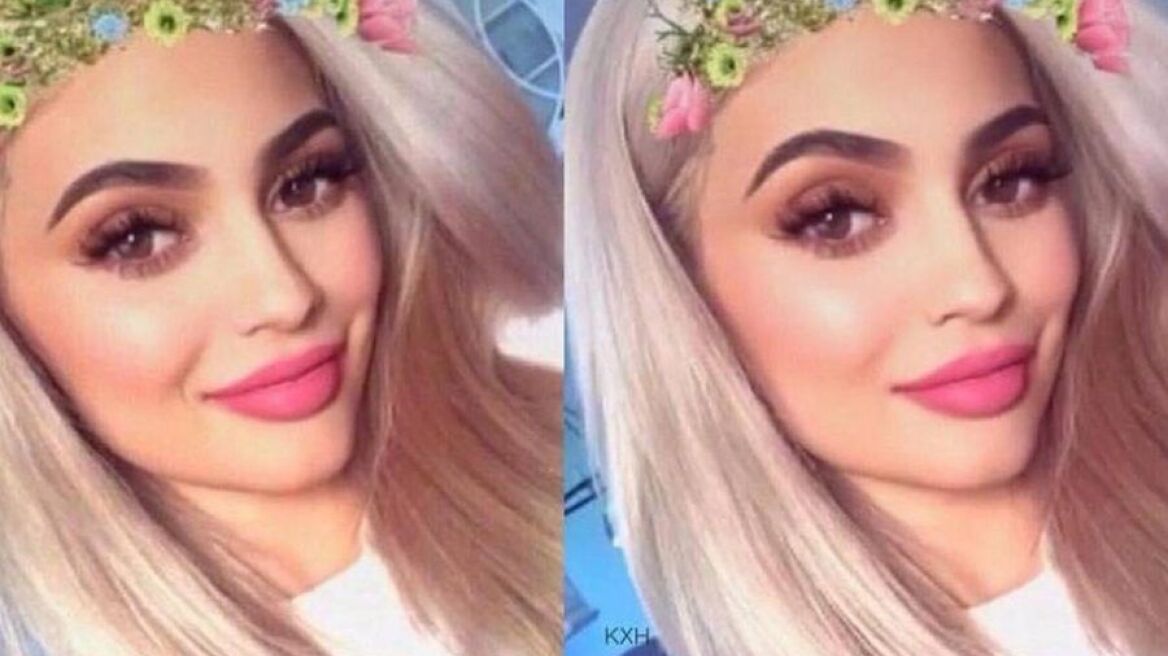 Μια selfie μπορεί να μας οδηγήσει στον πλαστικό χειρουργό;