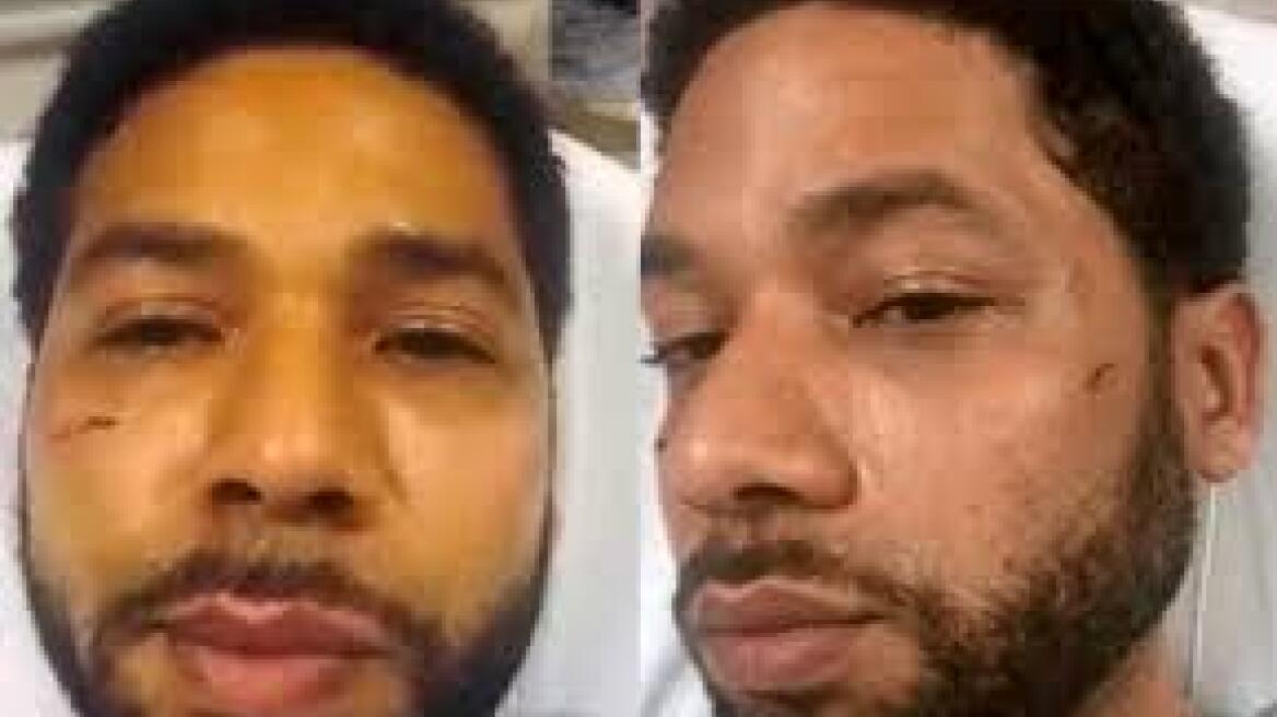 ΗΠΑ: 16 κατηγορίες σε βάρος γκέι μαύρου ηθοποιού που κατέθεσε ψευδώς ότι δέχτηκε ρατσιστική επίθεση!