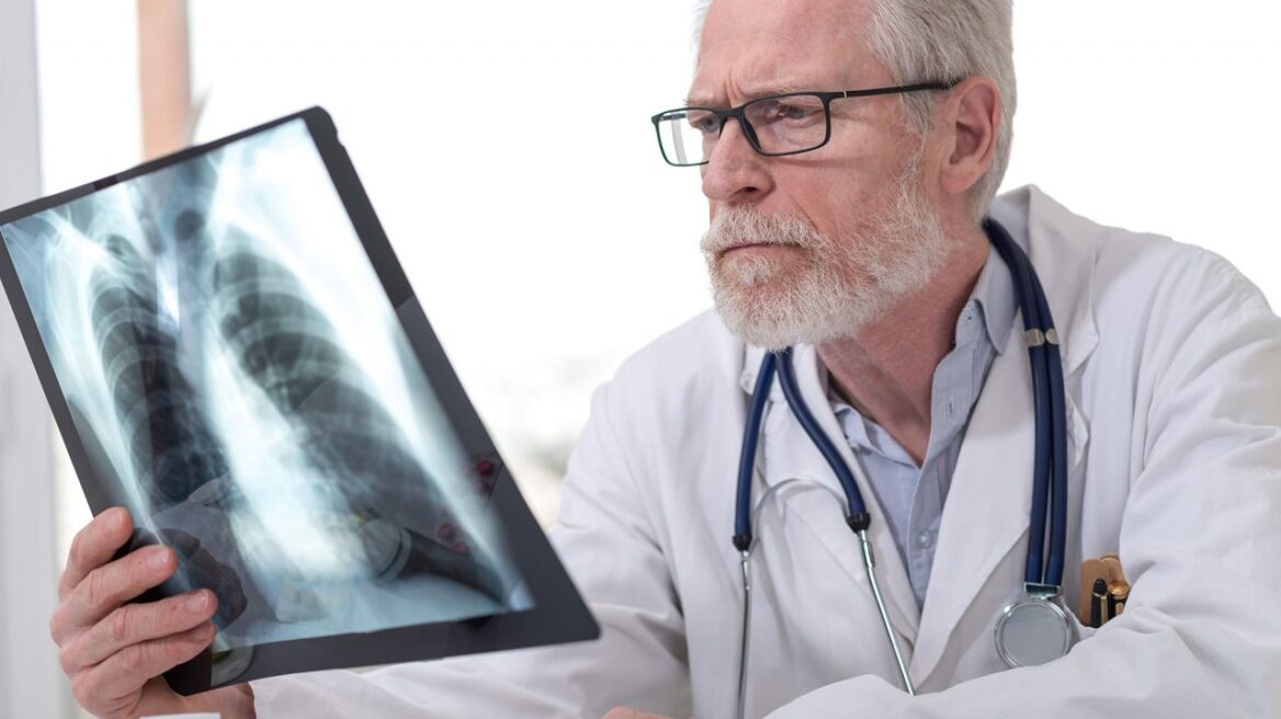 Φυματίωση: 1.300 κρούσματα κάθε χρόνο στην Ελλάδα